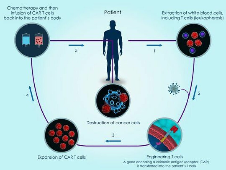 CAR T-celleterapi: T-celler høstes fra pasienten (eller frisk donor) og reprogrammeres med CAR- T celle reseptorer. Denne er designet for gjenkjennelse av spesifikke molekyler på kreftcellers overflate. Etter oppformering og reinfusjon i pasienten, kan T-cellene nå gjenkjenne og angripe kreftcellene.
        
      
      
        Foto: Getty Images