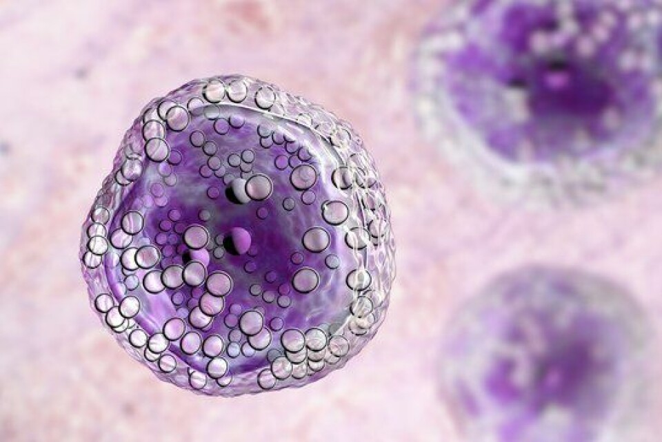 3D-bilde av en lymfomcelle - en kreftform som starter i lymfesystemet, som er en del av immunsystemet (Foto: Getty Images)
        
      
      
        Foto: Getty Images