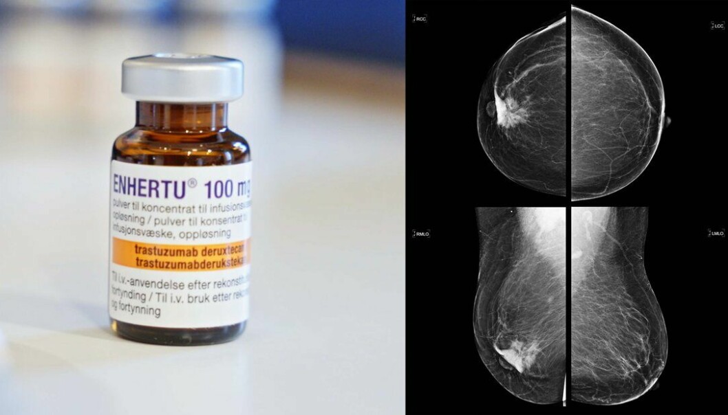 DESTINY-Breast04 ble søndag presentert på ASCO. Studien viser at det målrettede legemidlet Enhertu (trastuzumab deruxtecan), reduserer risikoen for kreftprogresjon eller død med imponerende 50 % og risiko for død med 36 % i pasienter som tidligere har fått behandling for HER2-lav metastatisk brystkreft.