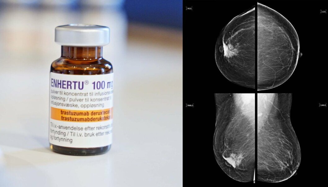 DESTINY-Breast04 ble søndag presentert på ASCO. Studien viser at det målrettede legemidlet Enhertu (trastuzumab deruxtecan), reduserer risikoen for kreftprogresjon eller død med imponerende 50 % og risiko for død med 36 % i pasienter som tidligere har fått behandling for HER2-lav metastatisk brystkreft. DESTINY-Breast04 ble søndag presentert på ASCO. Studien viser at det målrettede legemidlet Enhertu (trastuzumab deruxtecan), reduserer risikoen for kreftprogresjon eller død med imponerende 50 % og risiko for død med 36 % i pasienter som tidligere har fått behandling for HER2-lav metastatisk brystkreft.