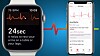 Apple Watch EKG - Trenger hjertet ditt det?