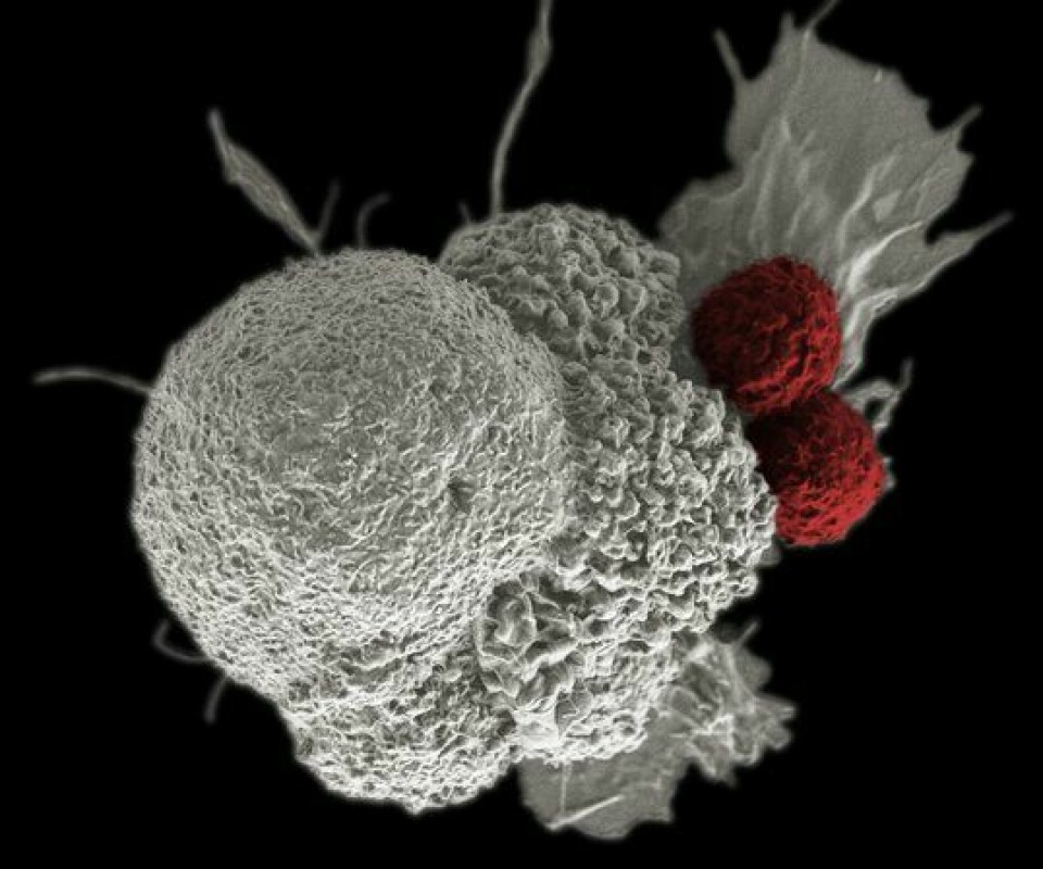 Høyoppløselig bilde som viser en kreftcelle (hvit) som angripes av to T-celler (rød). Yescarta og Breyanzi er celleterapier der pasientens egne T-celler hentes ut og genmodifiseres ved hjelp av en virusvektor som fører et gen inn i T-cellene slik at de kan feste seg til CD19-proteinet på kreftcellen og drepe kreften.
        
      
      
        National Institutes of Health