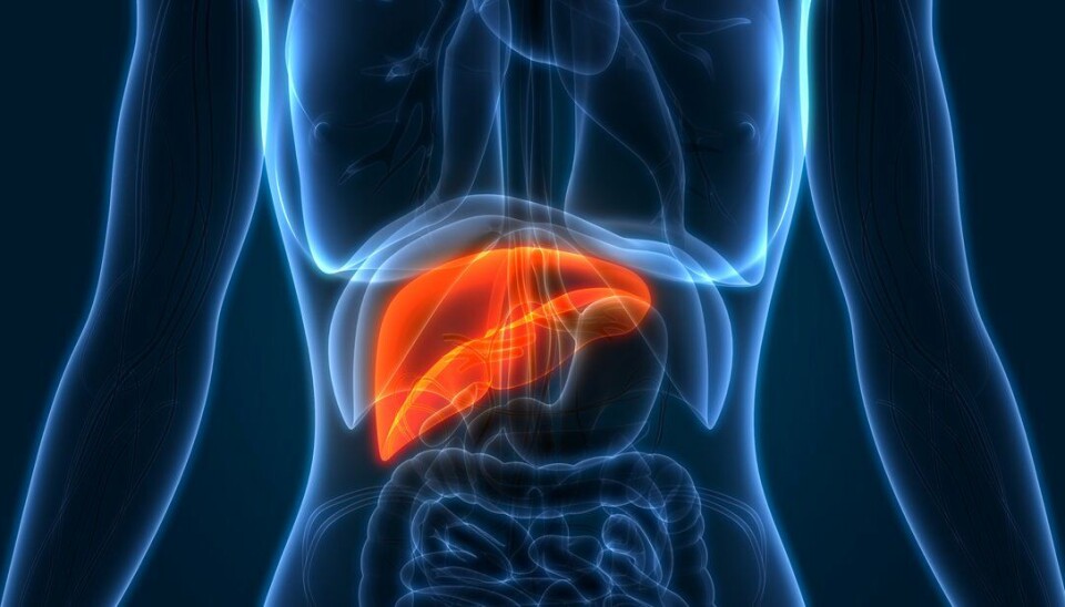 Tecentriq i kombinasjon med Avastin er det første og eneste immunterapi-regimet som er godkjent i Europa for inoperabel hepatocellulært karsinom. Nå gjenstår et godkjenning fra Beslutningsforum før behandlingen kan tilbys norske pasienter. Tecentriq i kombinasjon med Avastin er det første og eneste immunterapi-regimet som er godkjent i Europa for inoperabel hepatocellulært karsinom. Nå gjenstår et godkjenning fra Beslutningsforum før behandlingen kan tilbys norske pasienter.