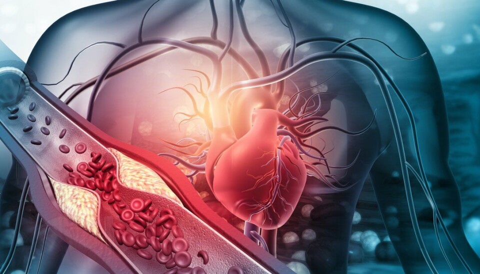 FDA har gitt grønt lys for Leqvio, for å senke nivået av forhøyede verdier av det «dårlige kolesterolet», LDL-C (low-density lipoprotein) hos pasienter som ikke har klart å oppnå tilstrekkelig reduksjon av LDL-C med statiner. Legemidlet er for tiden til vurdering for en europeisk markedsføringstillatelse hos EMA.