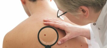 Ny studie: Over halvparten som får hudkreft med spredning overlever