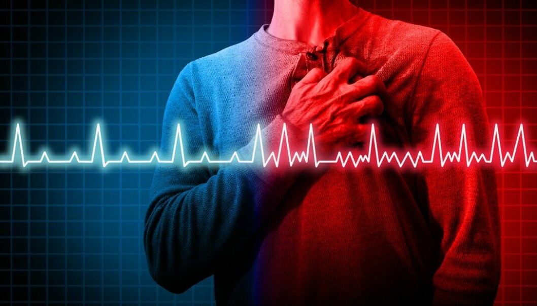 Personer med hjerteflimmer som oppfyller myndighetenes anbefalinger for fysisk aktivitet har omtrent halvert risiko for tidlig død sammenlignet med inaktive hjerteflimmerpasienter.