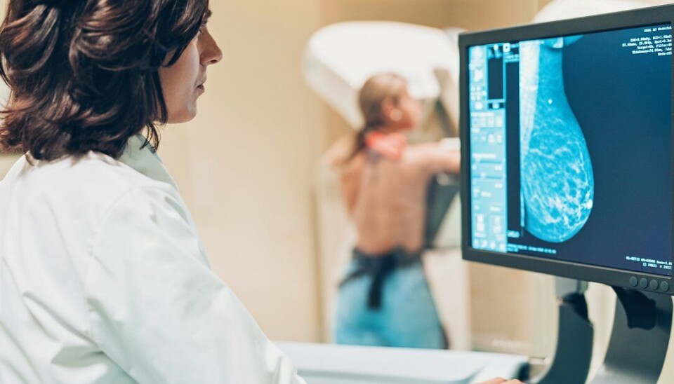 Mammografiprogrammet skal utvikle kunstig intelligens som skal hjelpe radiologene å bli enda mer presise og effektive i å avdekke brystkreft.
