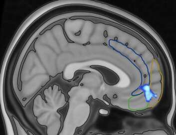 Forskerne mener området fungerer som en bryter
Illustrasjon fra Hugdahl et al., BioRxiv, 2020. Forskerne mener området fungerer som en bryter
Illustrasjon fra Hugdahl et al., BioRxiv, 2020.