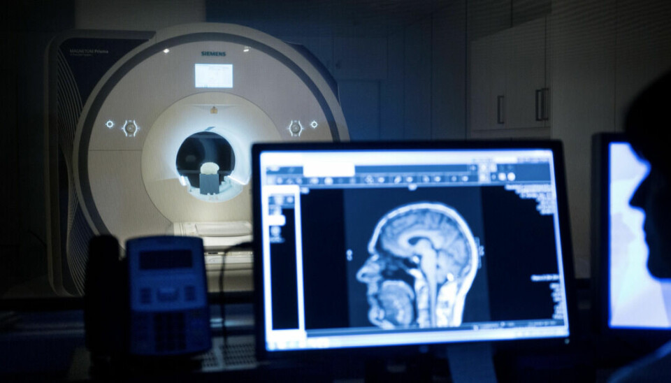 Hugdahl brukte en MR maskin for å måle de mest aktive områdene i hjernen når pasientene hørte stemmen