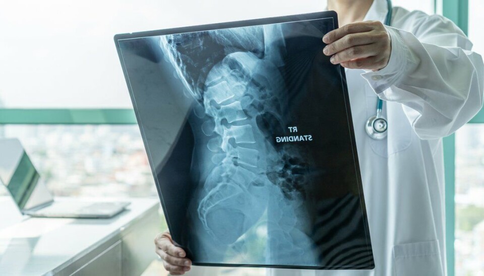 Zolgensma til behandling av Spinal muskelatrofi (SMA) nådde både sitt primære og sekundære endepunkt der pasientene kunne sitte på egenhånd i 30 sekunder og hjalp dem til å leve til 14 månedersalderen uten mekanisk pustehjelp.
