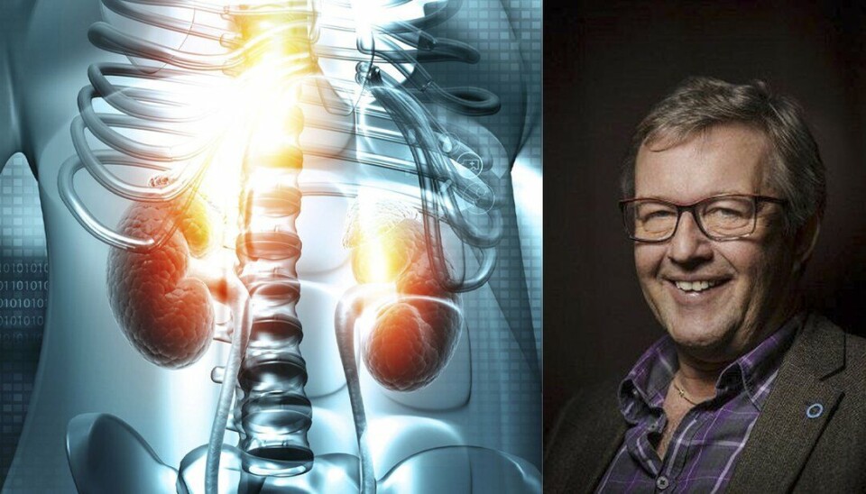 En gamechanger: - DAPA-CKD studien viser at behandlingen er like effektiv blant nyrepasientene som ikke har diabetes 2, som hos de med diabetes. Ut fra epidemiologiske studier vet vi at opptil halvparten av disse pasientene har en ikke-diabetisk årsak til sin nyresykdom, og jeg mener vi derfor kan konkludere at vi har en ny behandlingsmulighet ved kronisk nyresykdom generelt, sier Trond Geir Jensen.