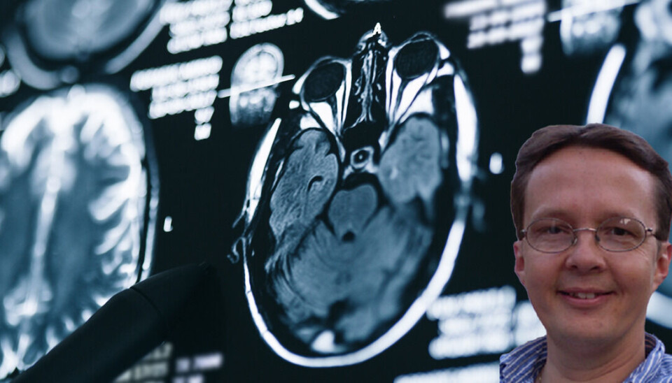 En studie viser at legemidlet Leukine som brukes til å øke antallet hvite blodlegemer etter kreftbehandling, også har en sykdomsbegrensende effekt og forbedrer hukommelsen hos pasienter med mild til moderat Alzheimers sykdom. - Resultatene i studien er interessante, men de bør tolkes med varsomhet, sier professor i farmakologi ved Universitetet i Oslo, Lars Nilsson.