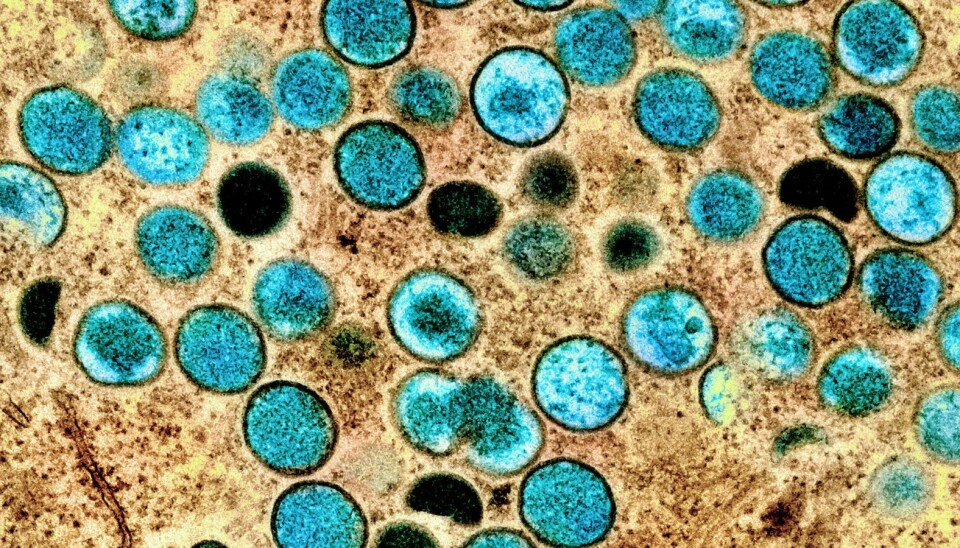 Farget elektronmikrografi av apekoppeviruspartikler (blågrønn) dyrket og renset fra cellekultur. Fedag ble det kjent at Helsedirektoratet og Folkehelseinstituttet anbefaler at Helse- og omsorgsdepartementet klassifiserer apekopper som en allmennfarlig smittsom sykdom