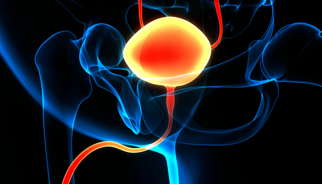 Vevsprøver tatt i prostata via området mellom endetarmen og urinrøret i stedet for via endetarmen kan redusere risikoen for alvorlige infeksjoner. Nå endres prosedyrene på alle norske sykehus.