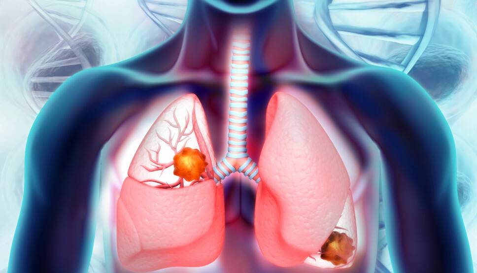 Immunterapien Jemperli oppnådde en objektiv responsrate ved metastatisk ikke-småcellet lungekreft som er bedre enn effekten til behandlingsstandarden Keytruda