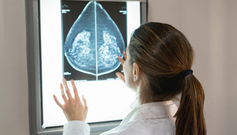 KAN REDDE LIV: Bildebehandlingsmuligheter som kontrastforsterket mammografi kan hjelpe med å forbedre diagnostisk treffsikkerhet, slik at man potensielt kan identfisere kreft som ellers ville blitt oversett, sier Dr. Julie Camps Herrero, sjef for brysthelse ved Ribera Salud-sykehusene i Spania, i en kommentar fra Bayer.