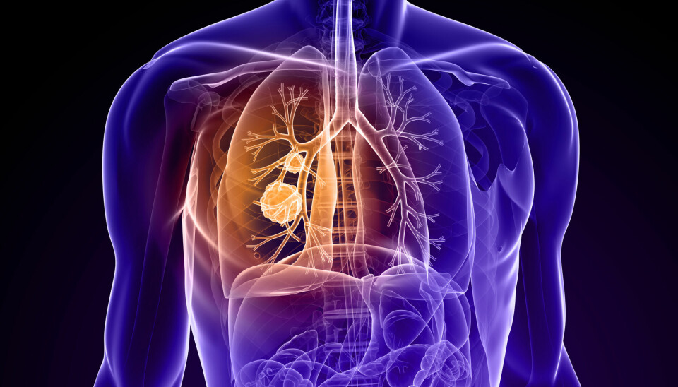 Nye data fra ADAURA-studien viser at pasienter med ikke-småcellet lungekreft i tidlig stadium med defekter i EGFR-genet som ble behandlet med Tagrisso overlever lengre