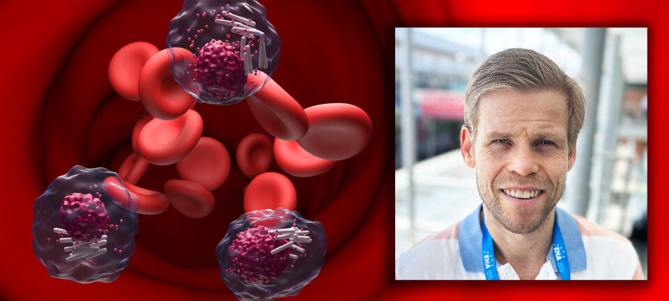 Norsk hematolog tror ny KLL-behandling kan bli førstevalg før 2030