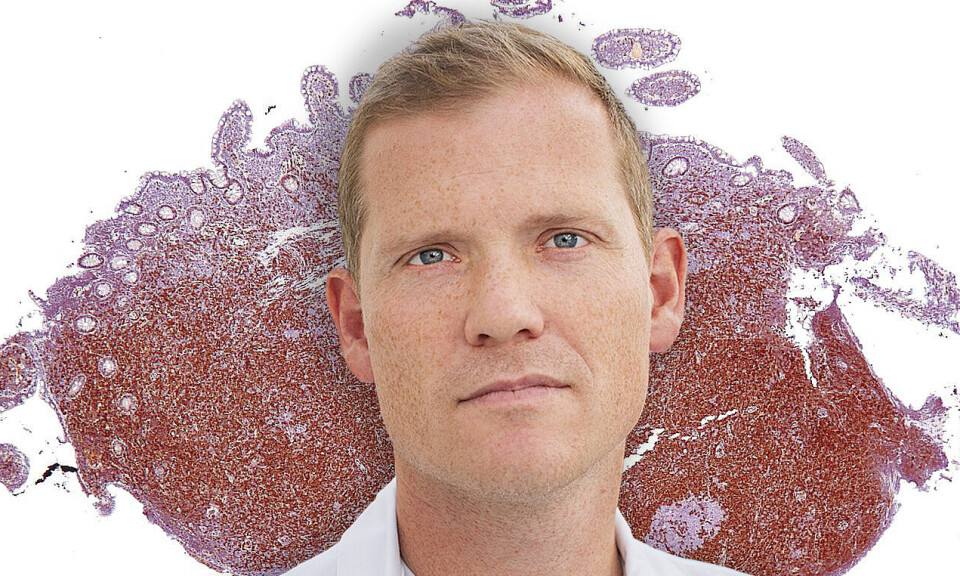 OUS-overlege Jon Riise på bilde med mantelcellelymfom